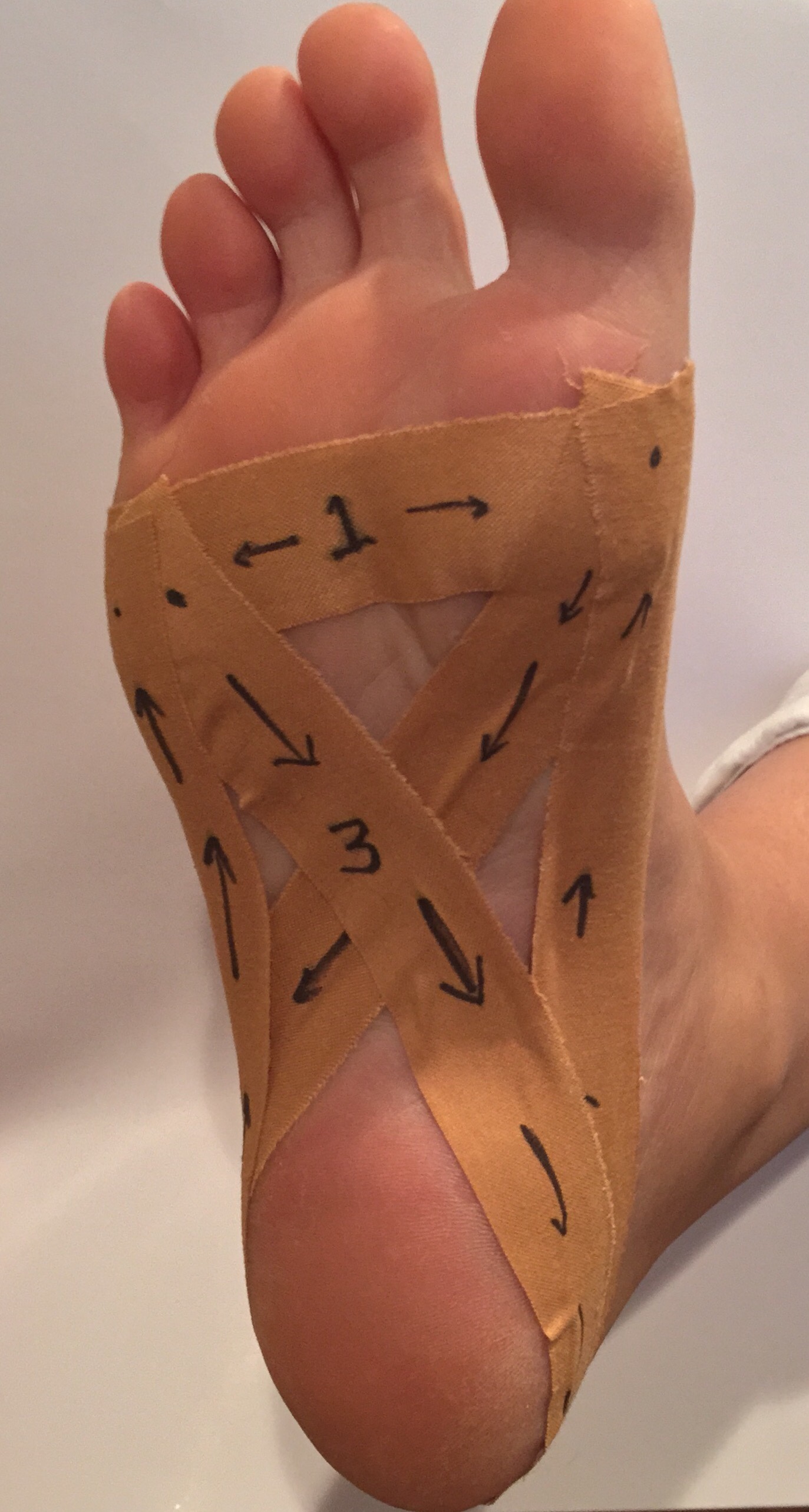 Plantar Fasciitis Treatment: How to Heal Heel Pain