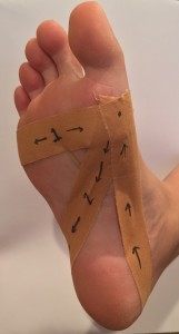 plantar fasciitis tape 2