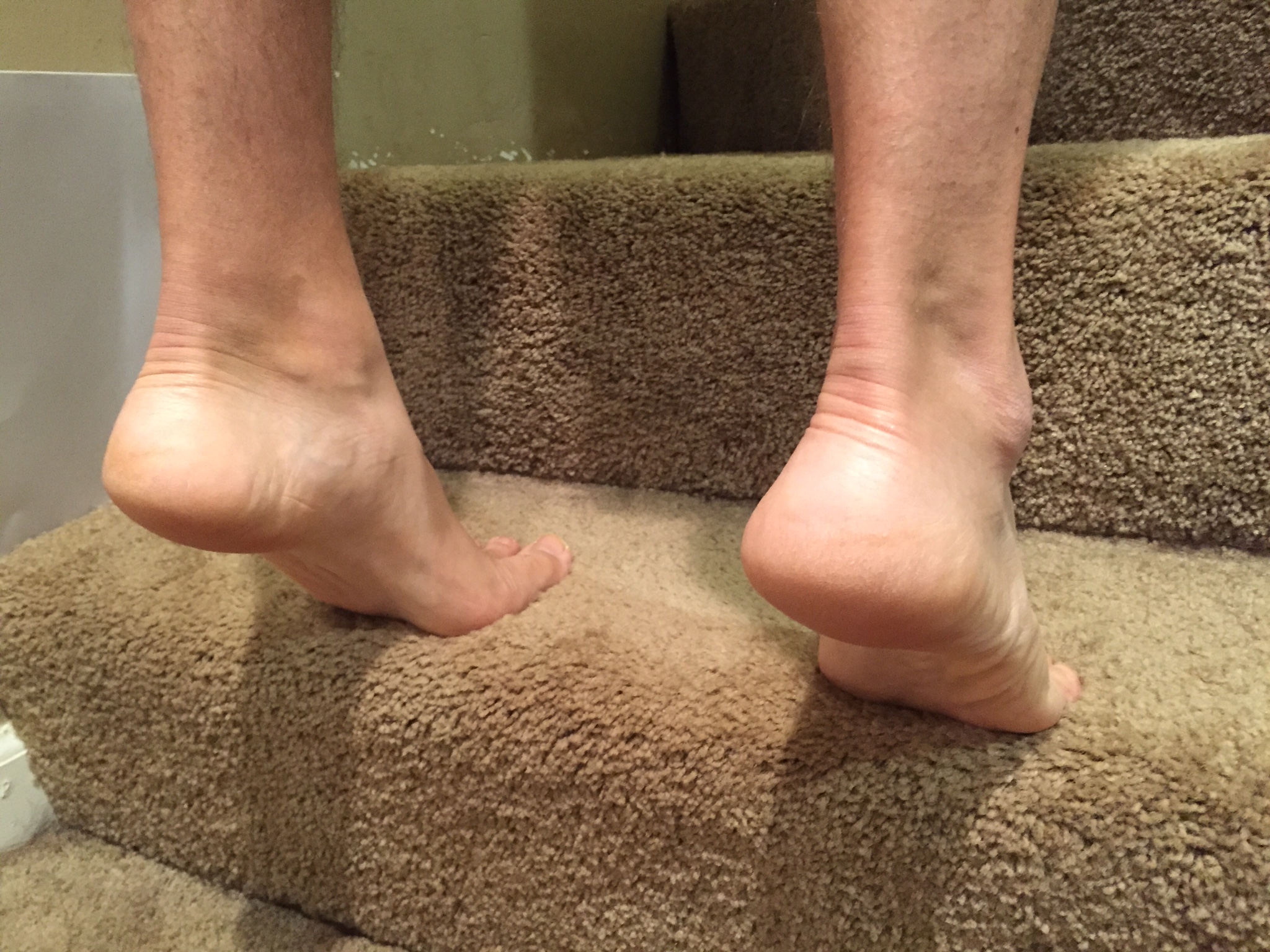 Plantar Fasciitis Treatment How to Heal Heel Pain