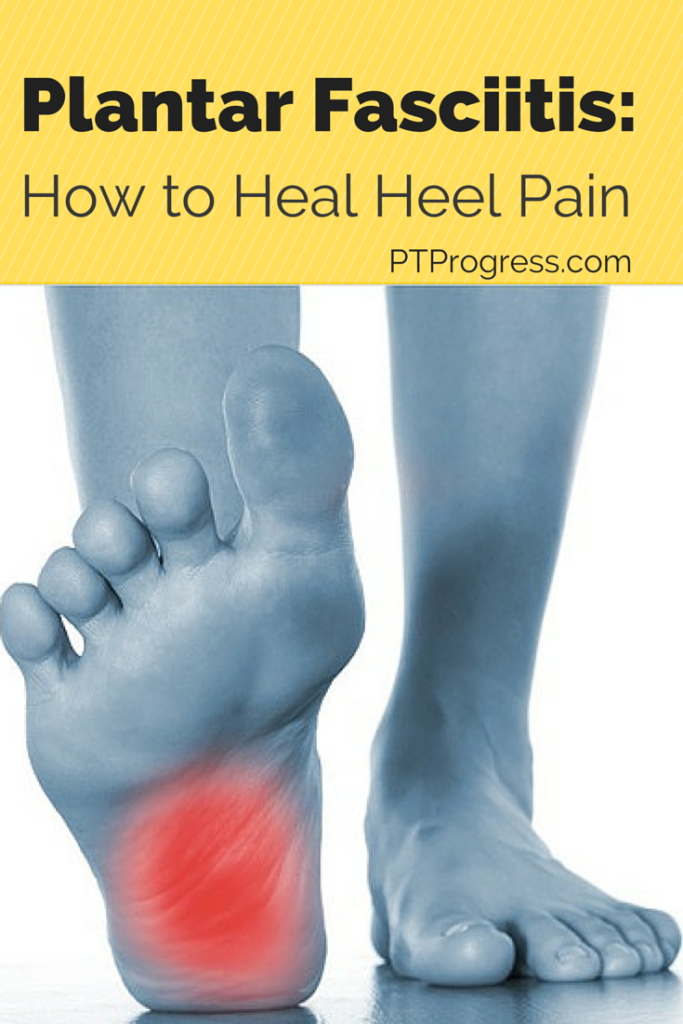 Treating Plantar Fasciitis