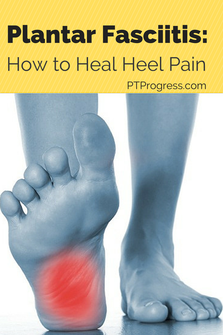 Plantar Fasciitis (Heel Pain)