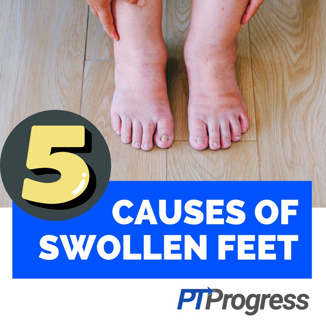 https://www.ptprogress.com/wp-content/uploads/2022/09/5-Reasons-You-Have-Swollen-Feet-and-Ankles-Instagram.jpg