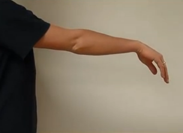 tennis elbow stretch