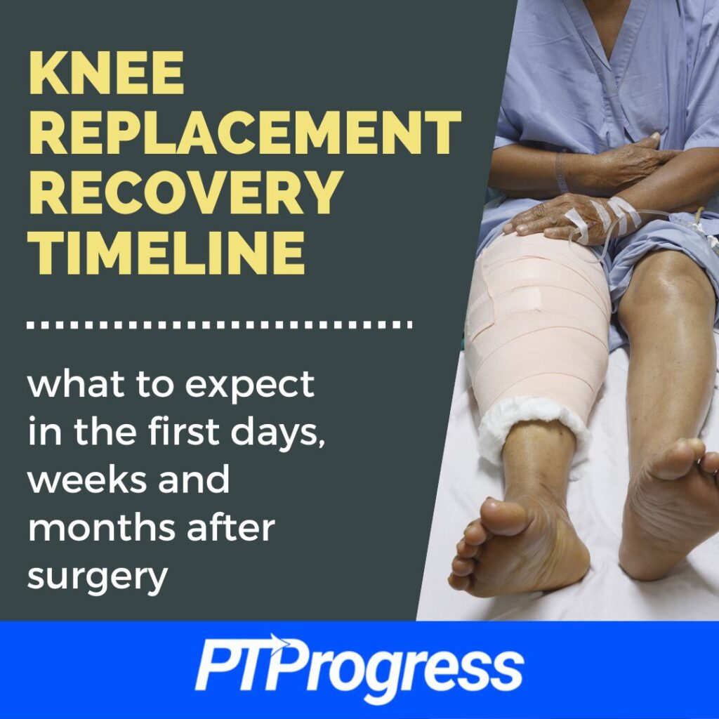 knee replacement recovery timeline